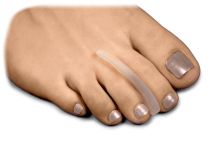 Toe_Separators_-_Main_-_Large.jpg